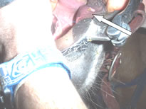 gum damage